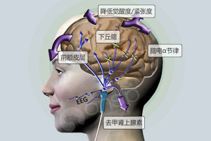 经颅磁刺激仪治疗效果好不好