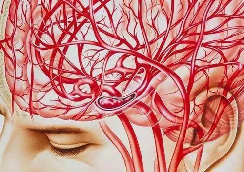 择思达斯磁疗|脑血栓是由什么原因引起的