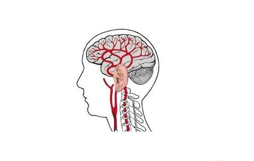 经颅磁刺激常见问题_脑血栓的预兆是什么症状